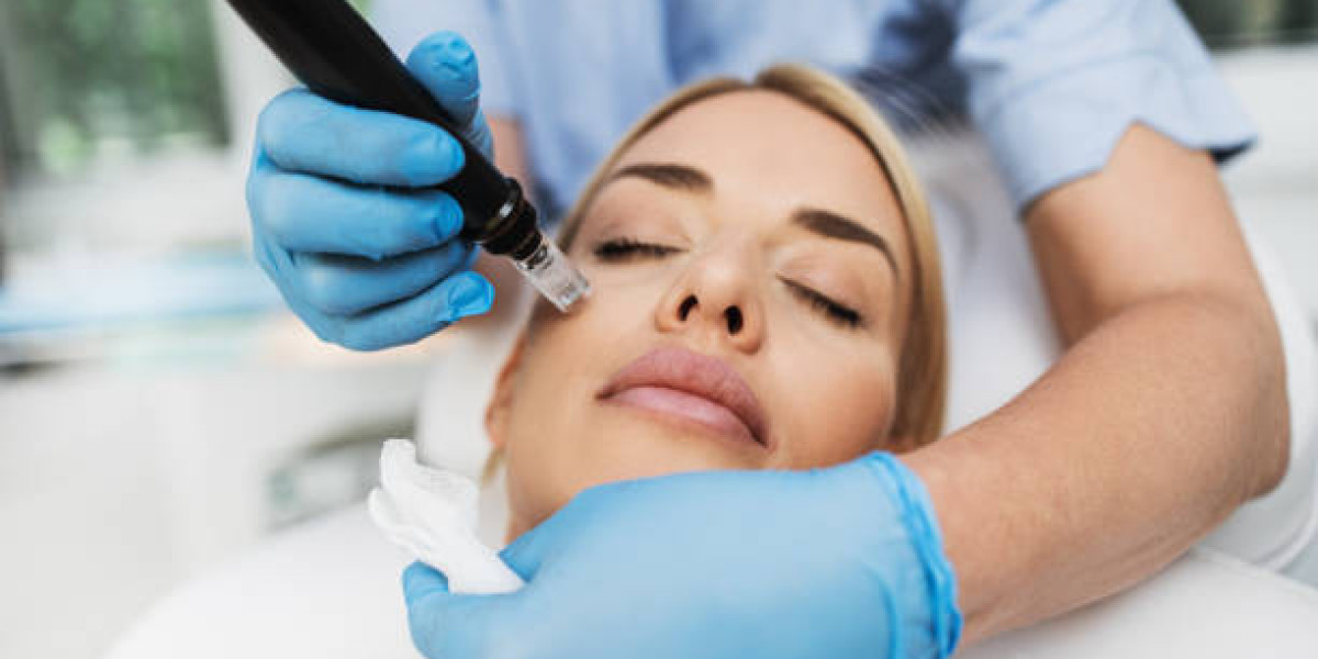 Transform Your Skin with PRP Microneedling