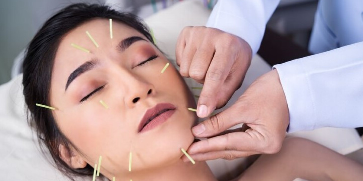 Effective Acupuncture Face Lift in Singapore