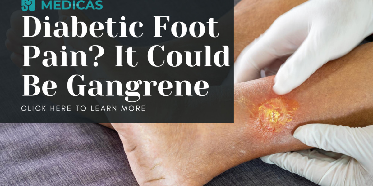 How to Recognize and Treat Gangrene in Diabetes Patients