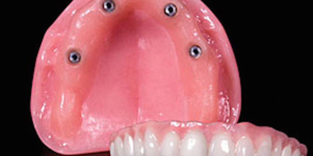 How to Handle Common Denture Repairs: A Step-by-Step Guide