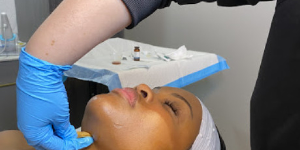 Discovering Youthful Radiance: Botox in The Woodlands, TX