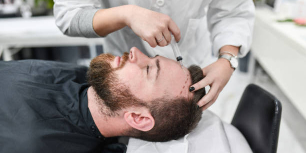 Personalized Hair Transplants: Tailoring Treatments in Riyadh