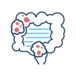 Colon Cancer Hospital