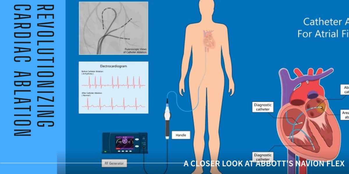 Terumo's Glidewire: Enhancing Vessel Navigation in Cardiac Catheterization