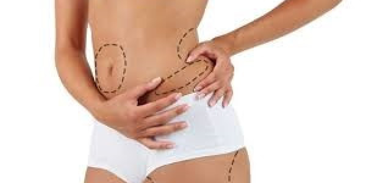 Transform Your Life with Liposuction Surgery in Dubai