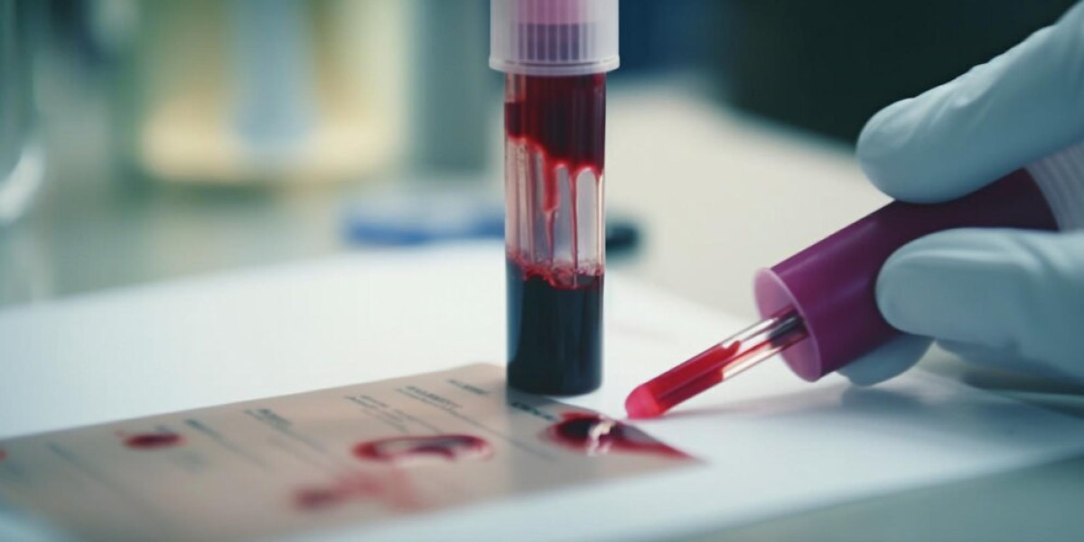 Germany Blood Testing Market: Size, Share, Trends, and Growth Forecast from 2023 to 2033