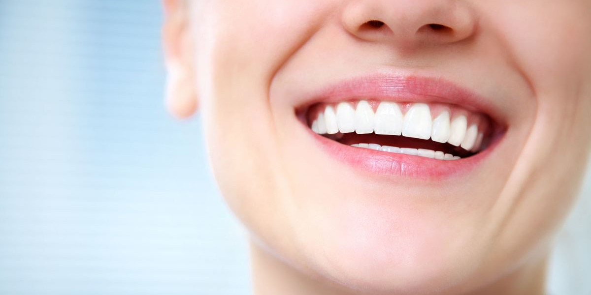 Teeth Whitening Strips Crest UK: Best Practices for a Perfect Smile