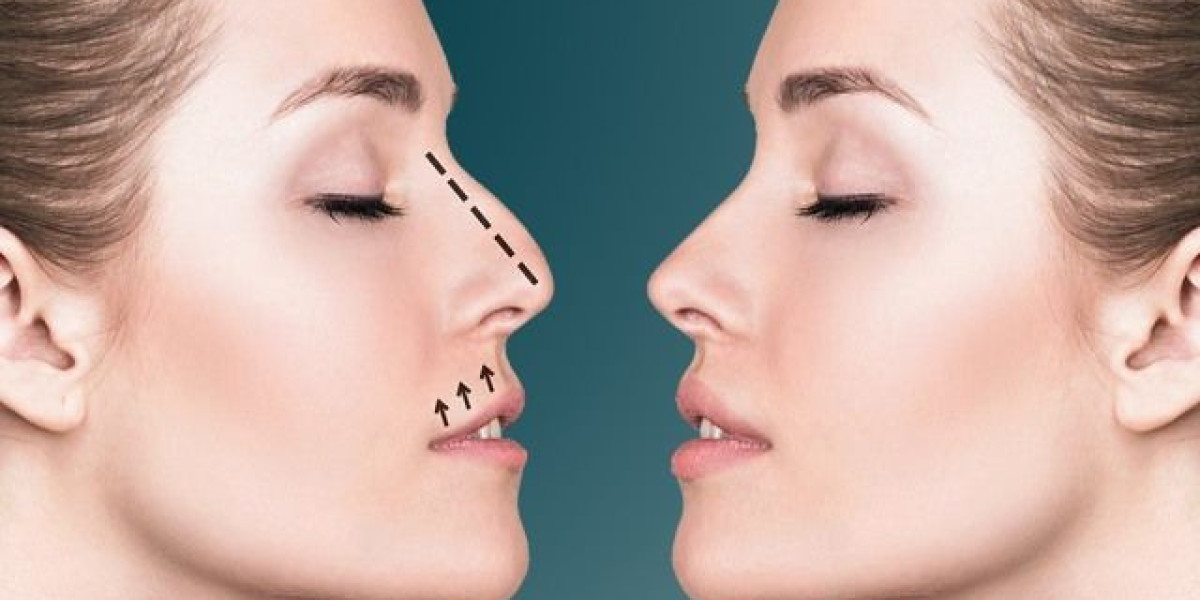 Feel Amazing with a Custom Rhinoplasty Surgery in Dubai!