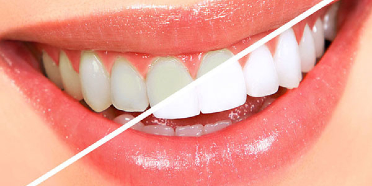 The Ultimate Guide to Dental Care and Services in Canberra, Australia
