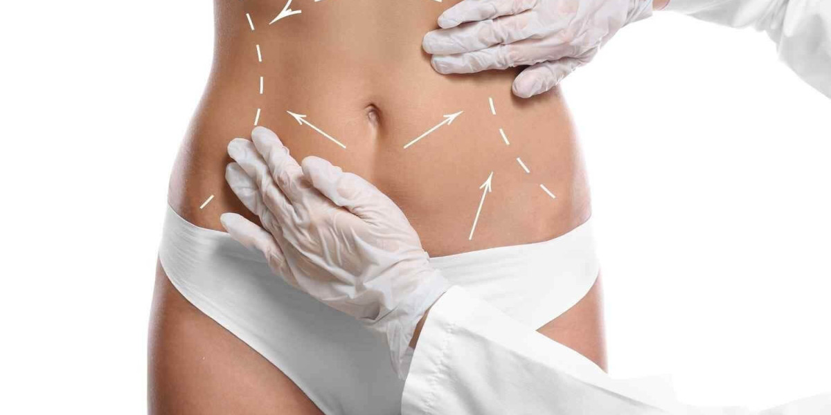 What to Expect from Liposuction Surgery in Dubai?