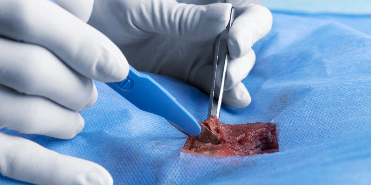 Surgical Wound Care Market: Innovations for Faster Healing and Better Outcomes