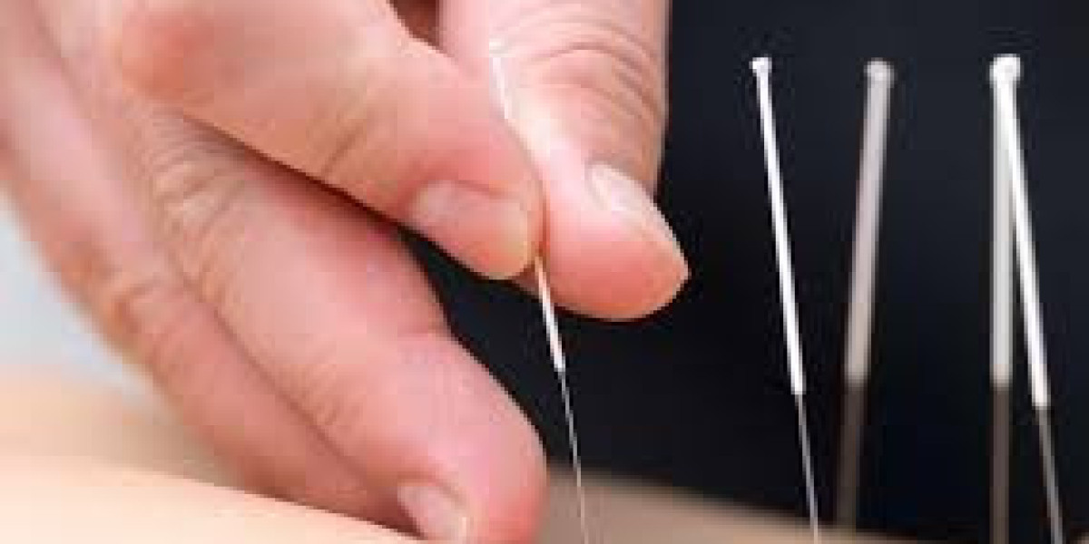 Acupuncture for Sports Performance: Risks and Precautions for Athletes