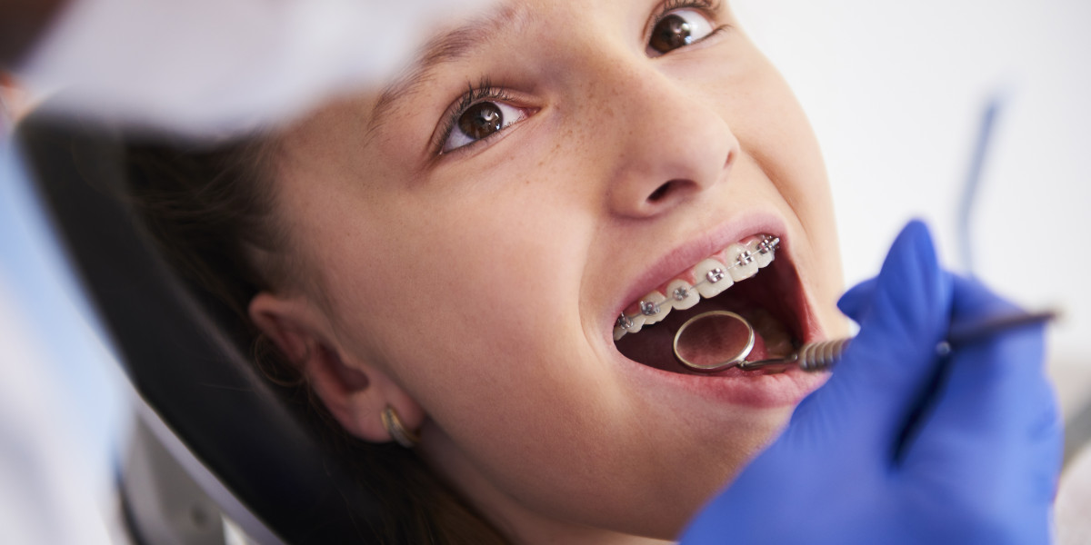 Can an Orthodontist Fix Jaw Alignment? Understanding Bite Correction