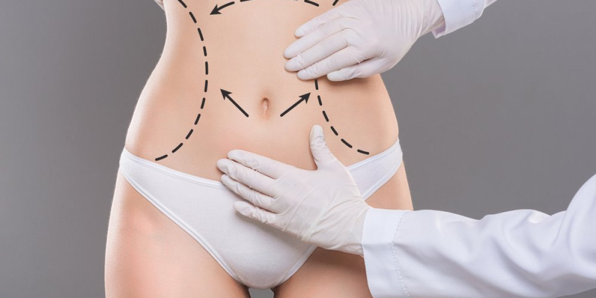 Transform Your Silhouette with Advanced Liposuction in Riyadh