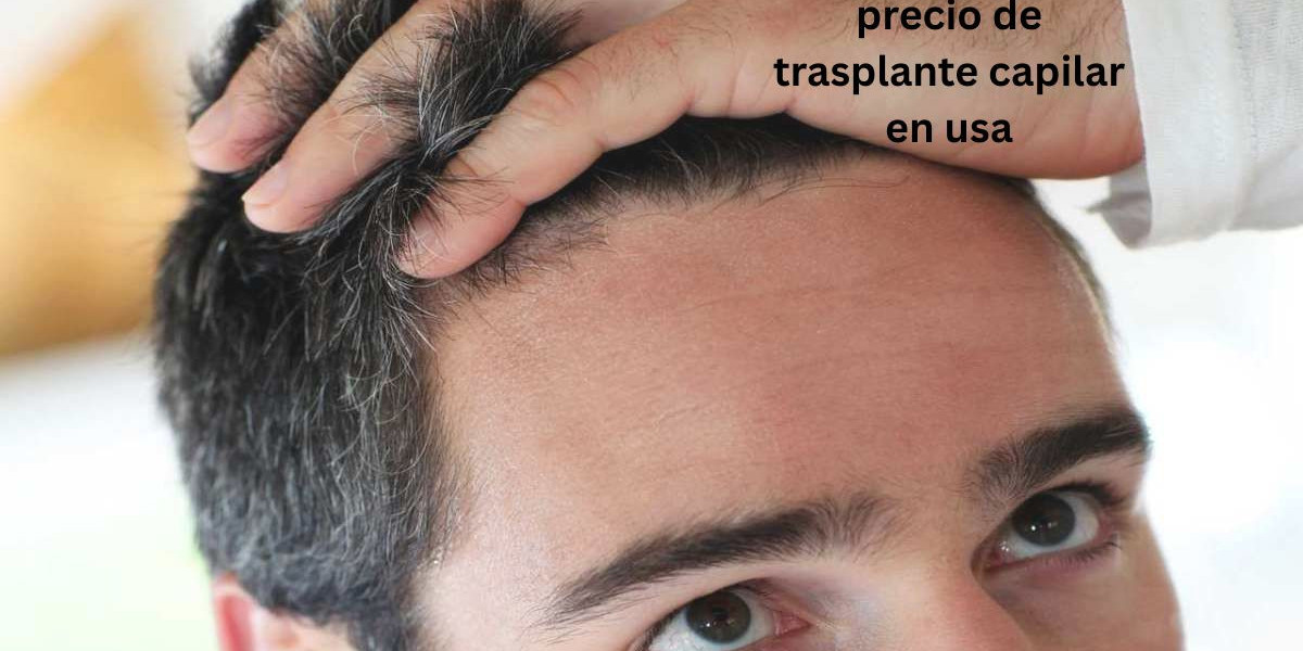 precio de trasplante capilar en usa