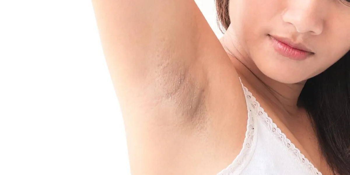 Armpit Whitening Treatment: The Best Products on the Market