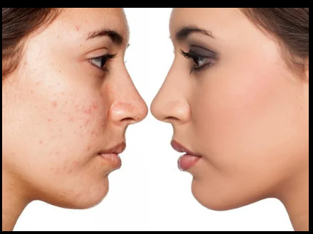 Jawline Enhancement Surgery: Define Your Look with Charm We Maintain