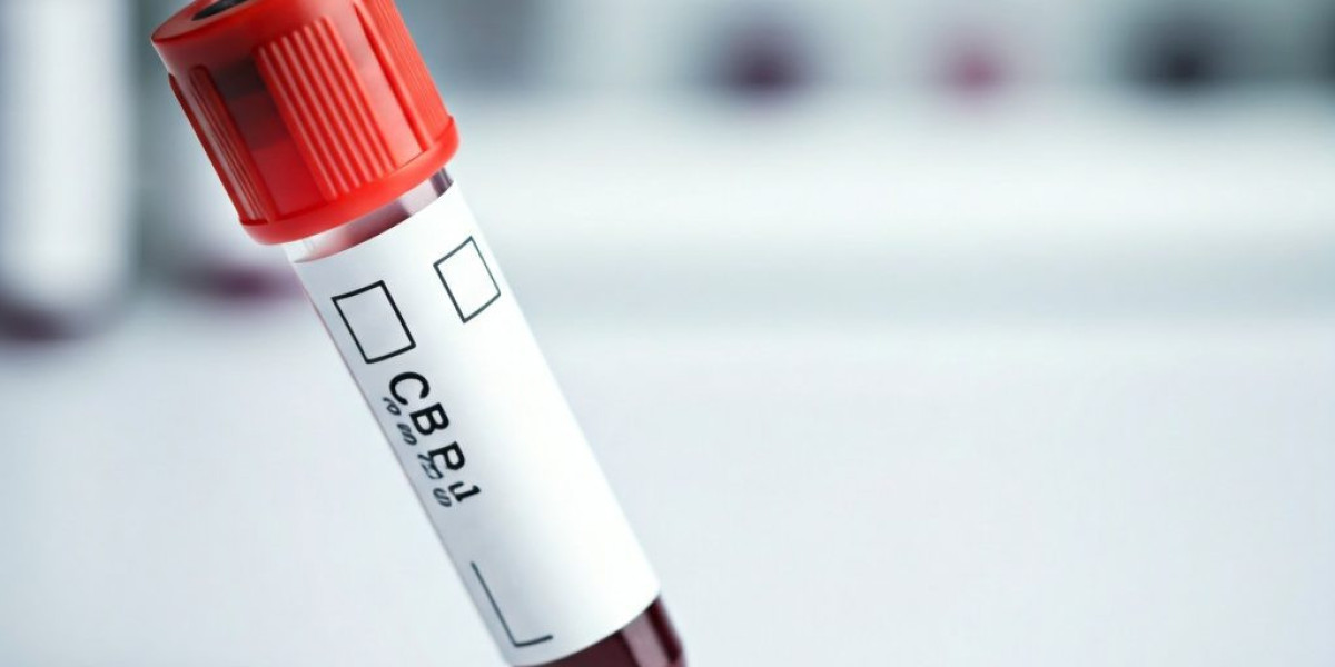Why a CBC Test at Simira Diagnostics Is Essential for Early Detection