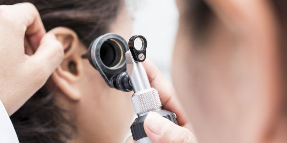 Ear Wax Removal in Ilford: Everything You Need to Know for Safe & Effective Care