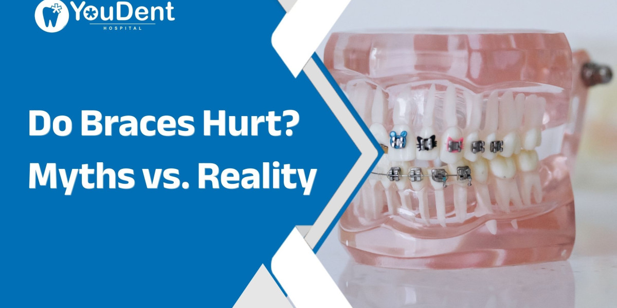 Do Braces Hurt? Myths vs. Reality