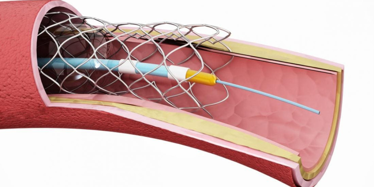 Angioplasty Balloons Market Trends, Innovations, and Competitive Landscape Shaping Future Industry Growth